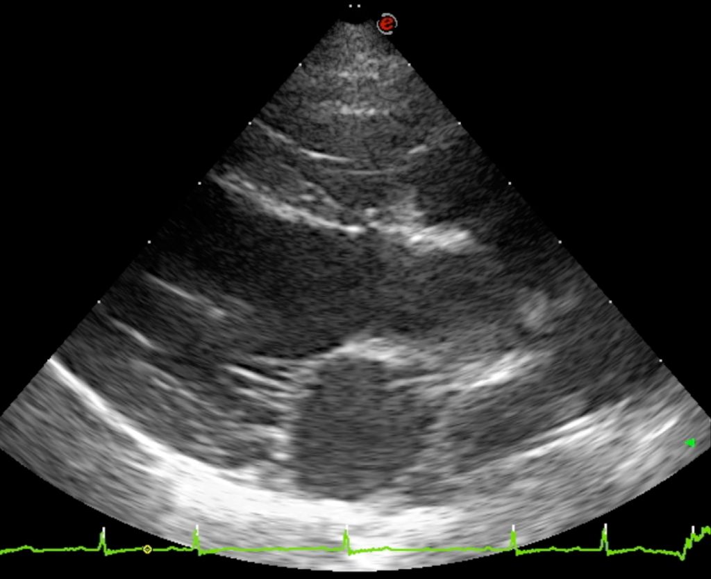 Du puits des sortileges - Tests cardiaques du 27/09